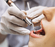 Dişleriniz İçin Doğru Ortodonti Tedavisi, Nasıl Seçilir 2