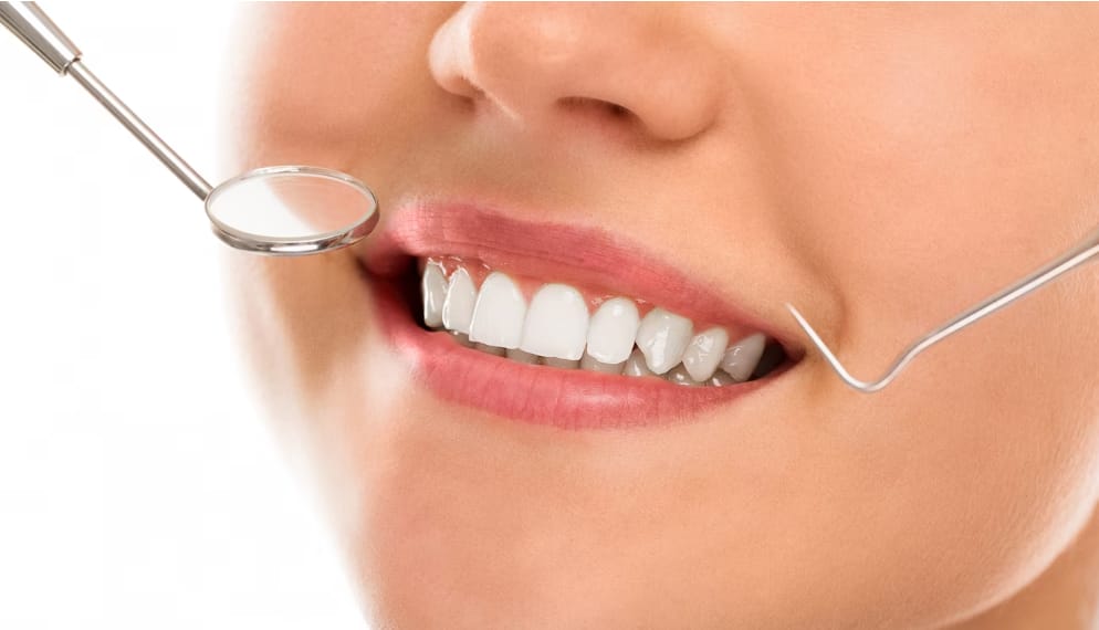 Diş Teli Tedavisi Fiyatları Ankara