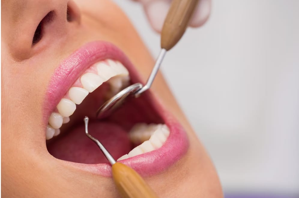 Ankara Ortodonti Uzmanı Görünmez Diş Teli