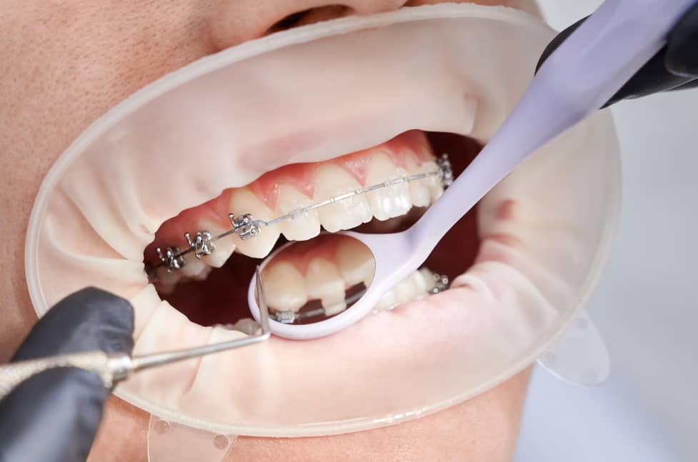 Ortodonti Kliniği